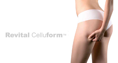 REVITAL CELLUFORM